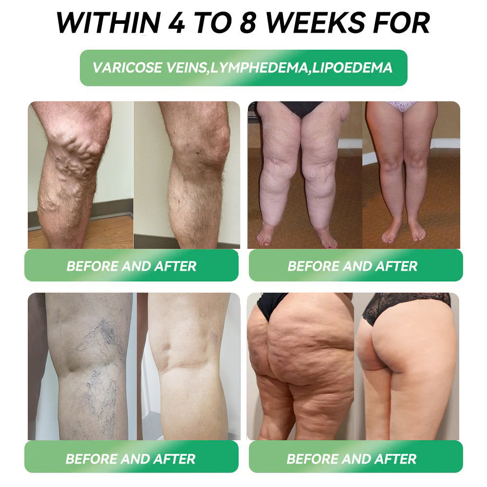 FDA| Official USA Store — Croaie® Telportide Oral Solution, GIP and GLP-1 Dual-Action Weight Loss Solution, One Bottle Daily, Results in 7 Days🛍️