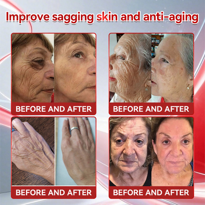 Last Day 50%off🔥NATO® 𝑮𝐋𝗣-𝟭 + 𝑪𝒐𝒍𝒍𝙖𝙜𝙚𝙣 𝐏𝐞𝐩𝒕𝒊𝒅𝒆𝒔 𝑾𝒆𝒊𝗴𝗵𝘁 𝐋𝐨𝐬𝐬 & 𝑭𝒊𝒓𝒎𝙞𝙣𝙜 𝑶𝒓𝒂𝐥 𝑺𝒐𝐥𝒖𝒕𝒊𝒐𝒏 💚💚 𝗼𝗯𝗲𝘀𝗶𝘁𝘆, 𝗳𝗶𝗿𝗺𝘀 𝘀𝗸𝗶𝗻, 𝗰𝗮𝗿𝗱𝗶𝗼𝘃𝗮𝘀𝗰𝘂𝗹𝗮𝗿 𝗱𝗶𝘀𝗲𝗮𝘀𝗲, 𝗱𝗶𝗮𝗯𝗲𝘁𝗲𝘀, 𝘀𝗹𝗲𝗲𝗽 𝗮𝗽𝗻𝗲𝗮, 𝗷𝗼𝗶𝗻𝘁 𝗽𝗿𝗼𝗯𝗹𝗲𝗺𝘀, 𝗮𝗻𝗱 𝗺𝗼𝗿e