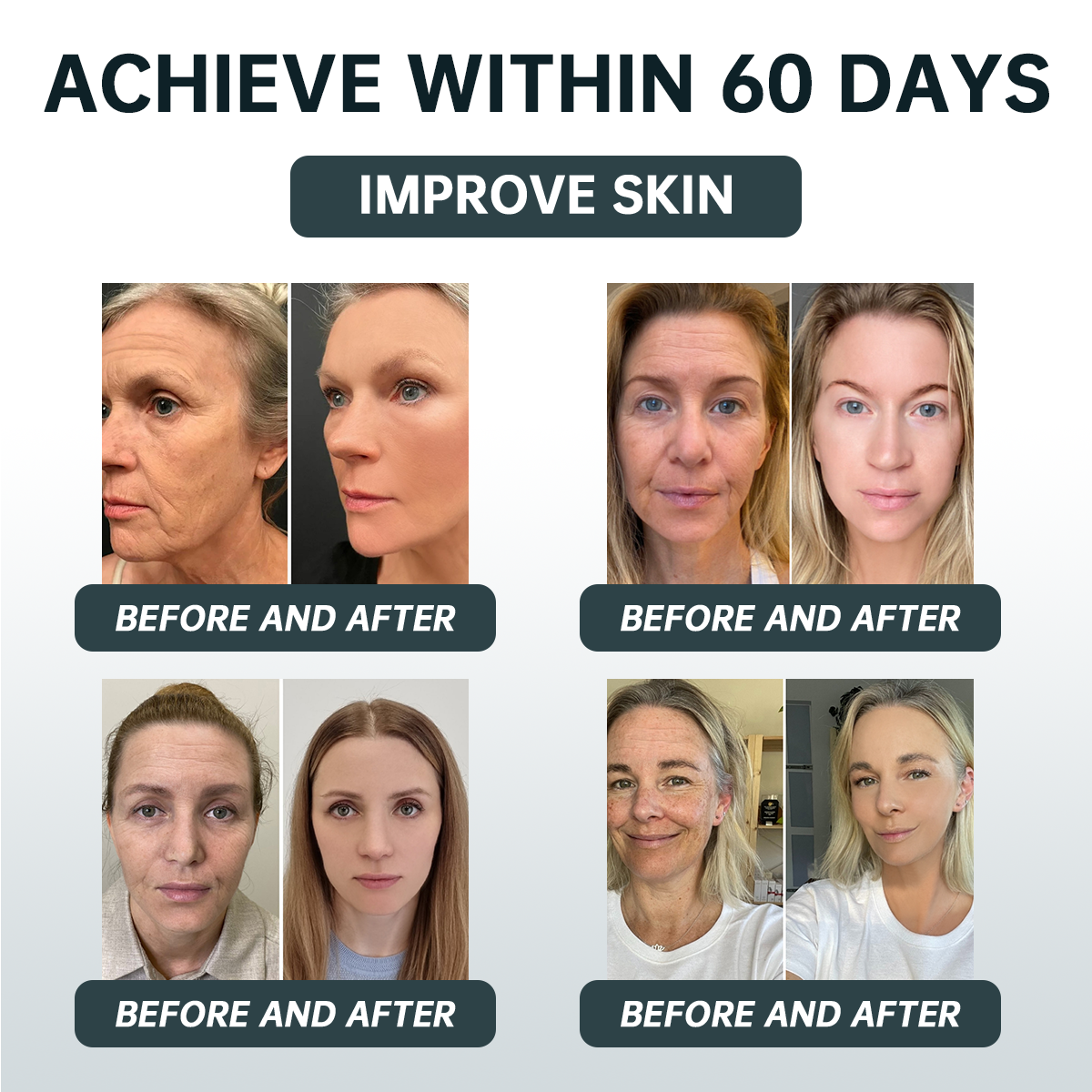 Last Day 50%off🔥ROSERUN™ Micro-infusion Advanced Collagen Enhancement Anti-aging Kit