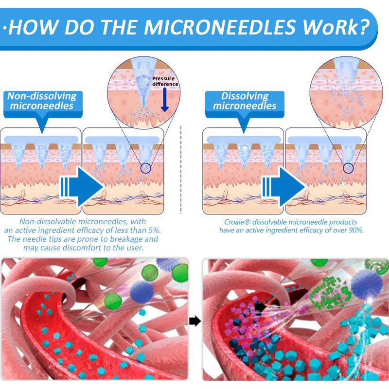 NATO® Nano Microneedle Patch with SMGT-GLP-1 & Matrixyl 3000 – Slimming, 👨‍⚕️Skin Tightening, 👨‍⚕️👨‍⚕️Blood Sugar Support, No Injection, 7-Day Result👨‍⚕️👨‍⚕️👨‍⚕️