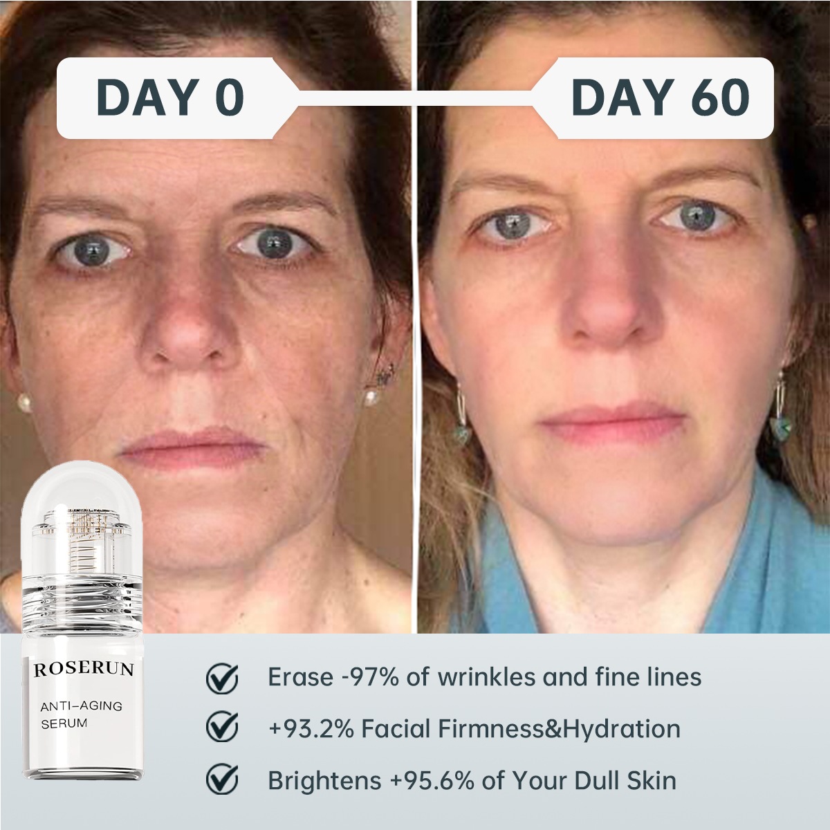 Last Day 50%off🔥ROSERUN™ Micro-infusion Advanced Collagen Enhancement Anti-aging Kit