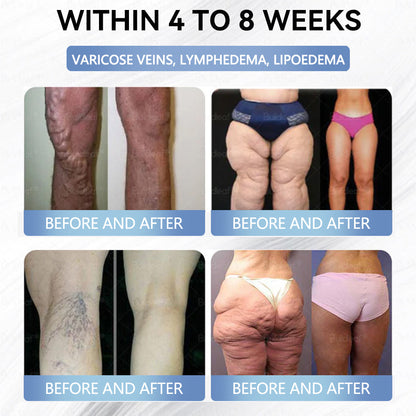 NATO® Nano Microneedle Patch with SMGT-GLP-1 & Matrixyl 3000 – Slimming, 👨‍⚕️Skin Tightening, 👨‍⚕️👨‍⚕️Blood Sugar Support, No Injection, 7-Day Result👨‍⚕️👨‍⚕️👨‍⚕️