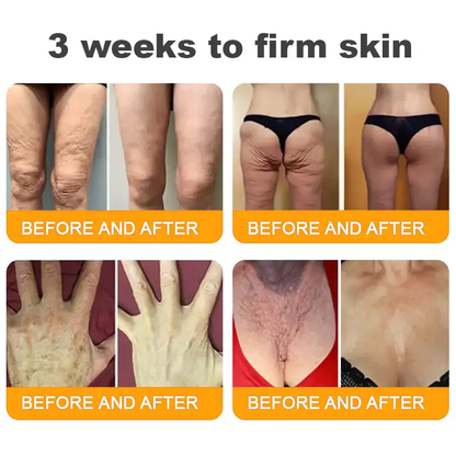 𝐋𝐎𝐕𝐈𝐋𝐃𝐒™ 𝐁𝐞𝐞 𝐕𝐞𝐧𝐨𝐦 𝐀𝐥𝐥-𝐢𝐧-𝐎𝐧𝐞 𝐂𝐫𝐞𝐚𝐦–🌸 Anti-aging,Hydrating, Skin Repair, Even Tone, Acne and Dark Spot Treatment, Wart and Mole Removal, Psoriasis Relief