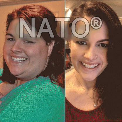 NATO® Nano Microneedle Patch with SMGT-GLP-1 & Matrixyl 3000 – Slimming, 👨‍⚕️Skin Tightening, 👨‍⚕️👨‍⚕️Blood Sugar Support, No Injection, 7-Day Result👨‍⚕️👨‍⚕️👨‍⚕️